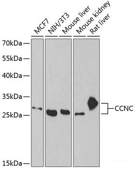 Immunofluorescence analysis of MCF-7 cells using QPCT Polyclonal Antibody