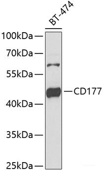 Immunohistochemistry of paraffin-embedded Human stomach using RAPSN Polyclonal Antibody at dilution of 1:100 (40x lens).