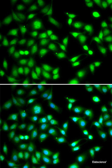 Immunofluorescence analysis of C6 cells using RECK Polyclonal Antibody at dilution of 1:100 (40x lens). Blue: DAPI for nuclear staining.