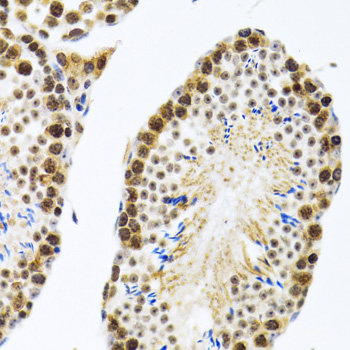 Immunofluorescence analysis of MCF7 cells using RPA3 Polyclonal Antibody