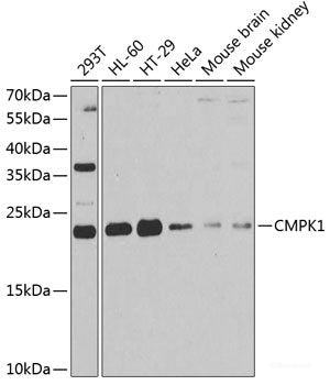 Immunohistochemistry of paraffin-embedded Human stomach using RPLP1 Polyclonal Antibody at dilution of 1:100 (40x lens).