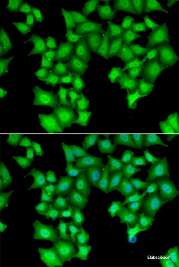 Immunohistochemistry of paraffin-embedded Human stomach using RPS2 Polyclonal Antibody at dilution of 1:100 (40x lens).