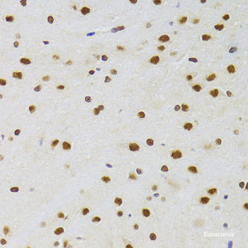 Immunohistochemistry of paraffin-embedded Rat brain using RPS7 Polyclonal Antibody at dilution of 1:100 (40x lens).