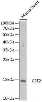 Immunohistochemistry of paraffin-embedded Human liver using SCO1 Polyclonal Antibody at dilution of 1:100 (40x lens).