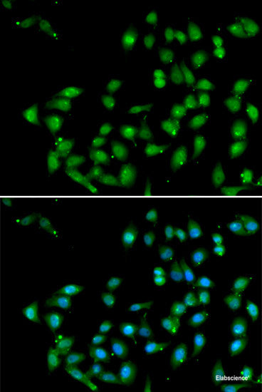 Western blot analysis of extracts of various cell lines using SCYL1 Polyclonal Antibody at dilution of 1:1000.