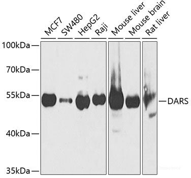 Immunohistochemistry of paraffin-embedded Human liver damage using SECISBP2 Polyclonal Antibody at dilution of 1:200 (40x lens).