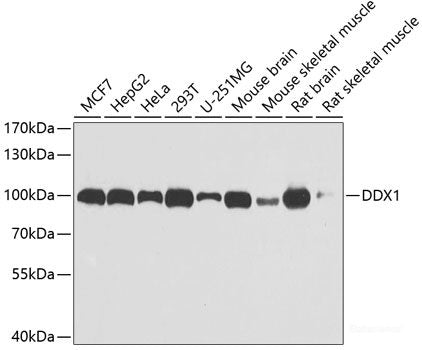 Immunofluorescence analysis of HeLa cells using MSRB1 Polyclonal Antibody