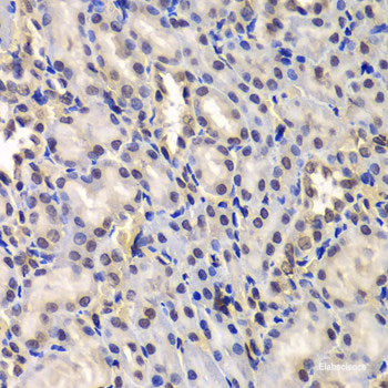 Immunofluorescence analysis of HeLa cells using SETMAR Polyclonal Antibody