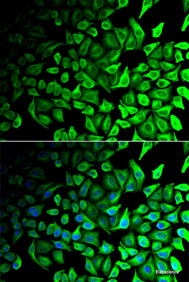 Immunofluorescence analysis of MCF7 cells using SLC23A2 Polyclonal Antibody