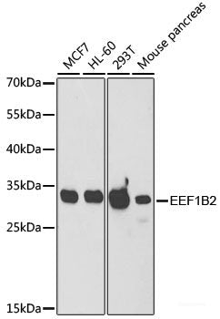 Western blot analysis of extracts of NCI-H125 cells using SLC26A3 Polyclonal Antibody at dilution of 1:1000.