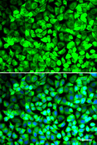Immunohistochemistry of paraffin-embedded Rat ovary using SMPD1 / ASM Polyclonal Antibody at dilution of 1:100 (40x lens).
