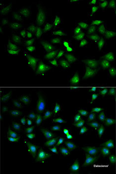 Western blot analysis of extracts of MCF-7 cells using SPINT2 Polyclonal Antibody at dilution of 1:1000.