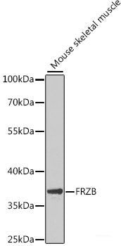 Immunohistochemistry of paraffin-embedded Human kidney using SPTLC1 Polyclonal Antibody at dilution of 1:100 (40x lens).