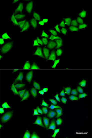 Western blot analysis of extracts of various cell lines using SRP19 Polyclonal Antibody at dilution of 1:1000.