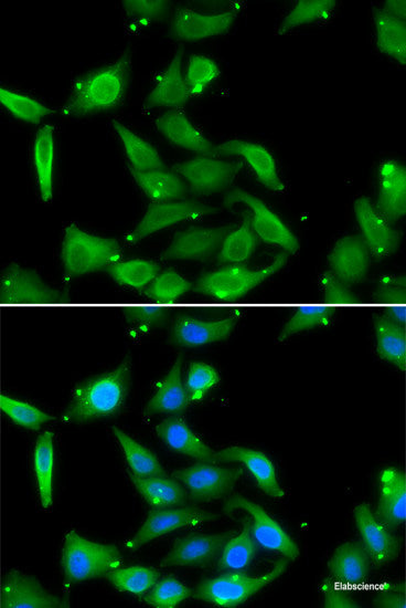 Western blot analysis of extracts of various cell lines using ST3GAL3 Polyclonal Antibody at dilution of 1:1000.