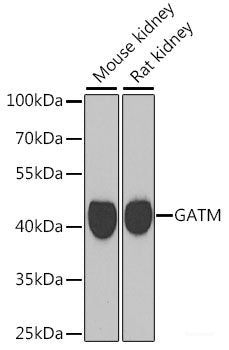 Western blot analysis of extracts of various cell lines using ST8SIA4 Polyclonal Antibody at dilution of 1:1000.