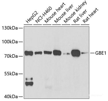 Western blot analysis of extracts of Mouse lung using STC1 Polyclonal Antibody at dilution of 1:1000.