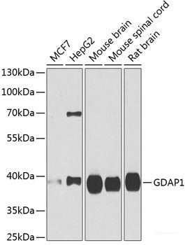 Immunohistochemistry of paraffin-embedded Mouse lung using STRN3 Polyclonal Antibody at dilution of 1:100 (40x lens).