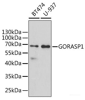 Western blot analysis of extracts of various cell lines using TAGLN Polyclonal Antibody at dilution of 1:1000.