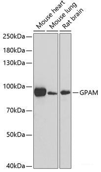 Western blot analysis of extracts from normal (control) and TAGLN2 knockout (KO) 293T cells using TAGLN2 Polyclonal Antibody at dilution of 1:1000.