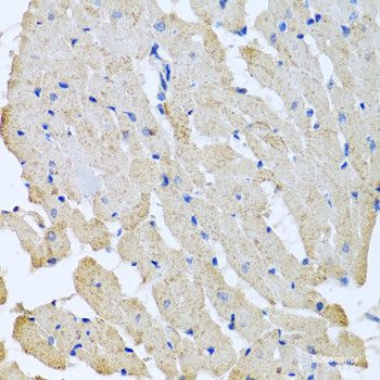 Immunofluorescence analysis of HeLa cells using TALDO1 Polyclonal Antibody