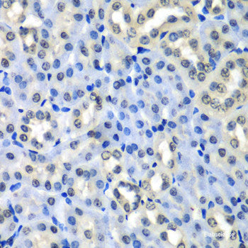 Immunofluorescence analysis of HeLa cells using TANK Polyclonal Antibody