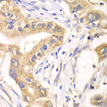 Immunofluorescence analysis of MCF-7 cells using TAT Polyclonal Antibody