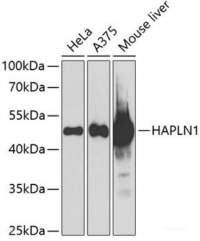 Western blot analysis of extracts of various cell lines using TEAD1 Polyclonal Antibody at dilution of 1:1000.