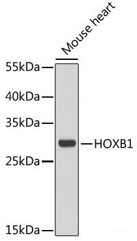 Western blot analysis of extracts of various cell lines using TLK2 Polyclonal Antibody at dilution of 1:1000.