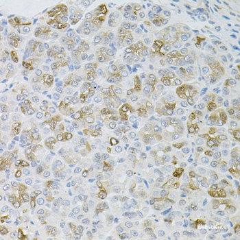 Immunohistochemistry of paraffin-embedded Rat kidney using TMED10 Polyclonal Antibody at dilution of 1:100 (40x lens).