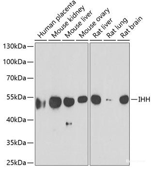 Western blot analysis of extracts of various cell lines using TRAPPC10 Polyclonal Antibody at dilution of 1:1000.