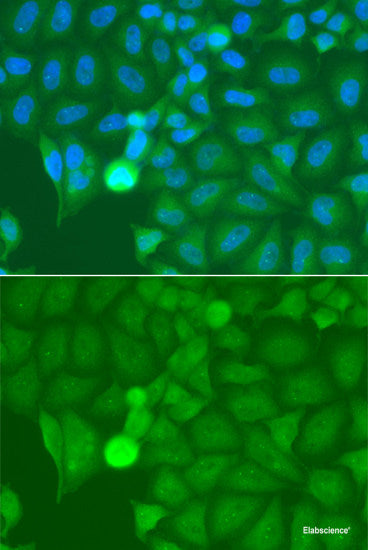 Immunofluorescence analysis of HeLa cells using USP15 Polyclonal Antibody at dilution of 1:100 (40x lens). Blue: DAPI for nuclear staining.