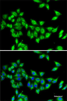 Western blot analysis of extracts of various cell lines using XPO5 Polyclonal Antibody.