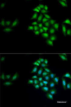 Immunohistochemistry of paraffin-embedded Rat liver using CPT1B Polyclonal Antibody at dilution of 1:100 (40x lens).