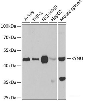 Western blot analysis of extracts of Jurkat cells using ABHD5 Polyclonal Antibody.