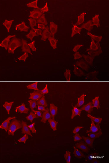 Western blot analysis of extracts of various cell lines using Argonaute-2 Polyclonal Antibody at dilution of 1:1000.