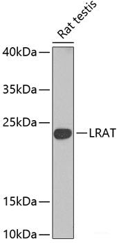 Western blot analysis of extracts of 293T cells using CCS Polyclonal Antibody at dilution of 1:1000.