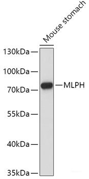 Western blot analysis of extracts of various cell lines using HUS1B Polyclonal Antibody at dilution of 1:1000.