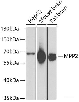 Immunohistochemistry of paraffin-embedded Rat brain using MUS81 Polyclonal Antibody at dilution of 1:100 (40x lens).