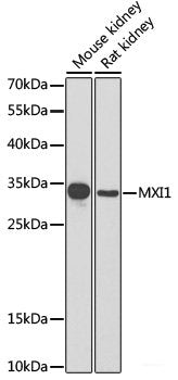 Western blot analysis of extracts of Rat heart using POLR2F Polyclonal Antibody at dilution of 1:3000.