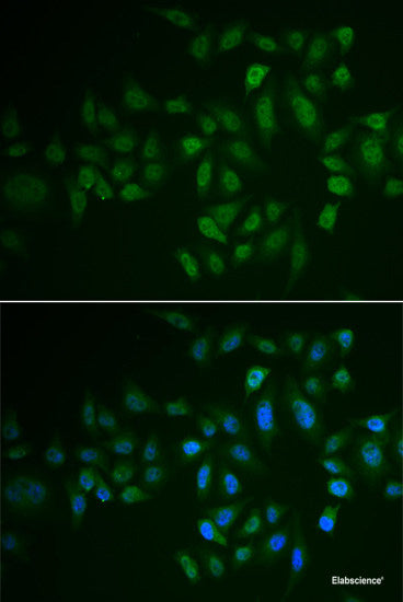 Immunohistochemistry of paraffin-embedded Rat liver using WDR48 Polyclonal Antibody at dilution of 1:100 (40x lens).