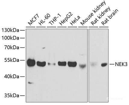 Western blot analysis of extracts of Rat kidney using ABCA3 Polyclonal Antibody at dilution of 1:1000.