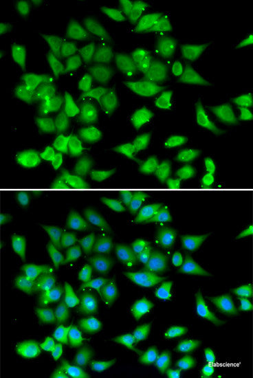 Western blot analysis of extracts of various cell lines using AP2A1 Polyclonal Antibody at dilution of 1:1000.