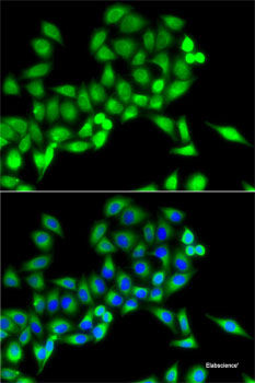 Western blot analysis of extracts of various cell lines using ALOX15B Polyclonal Antibody at dilution of 1:1000.