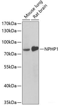 Immunohistochemistry of paraffin-embedded Human liver damage using ASGR1 Polyclonal Antibody at dilution of 1:100 (40x lens).
