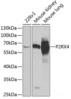 Western blot analysis of extracts of various cell lines using ATP6V1B1 Polyclonal Antibody at dilution of 1:1000.