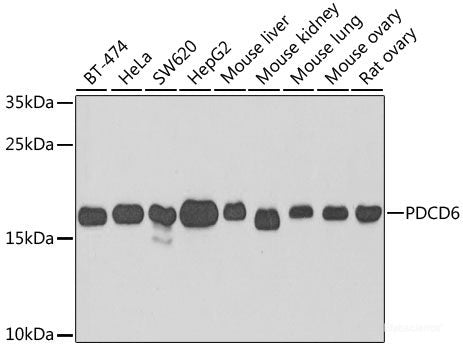 Immunohistochemistry of paraffin-embedded Rat kidney using C1S Polyclonal Antibody at dilution of 1:200 (40x lens).