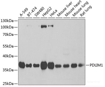 Immunofluorescence analysis of HeLa cells using KRIT1 Polyclonal Antibody