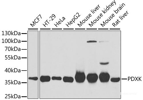 Western blot analysis of extracts of Mouse testis using ERCC8 Polyclonal Antibody at dilution of 1:1000.