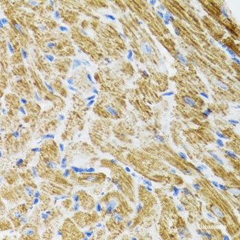 Western blot analysis of extracts of MCF-7 cells using CYP4B1 Polyclonal Antibody at dilution of 1:1000.